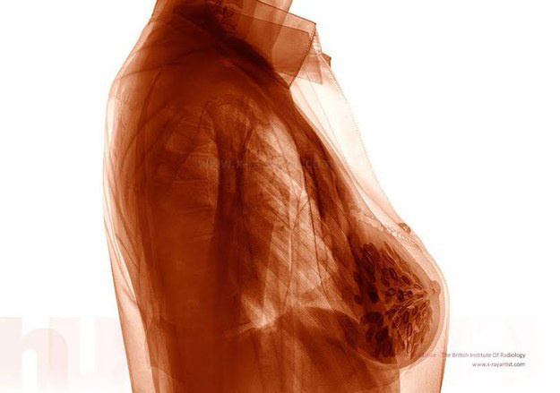 foto hasil sinar rontgent © 2016 brilio.net