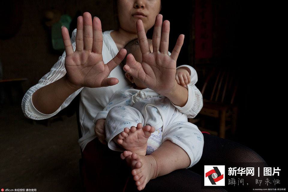 bayi jari banyak © 2016 brilio.net