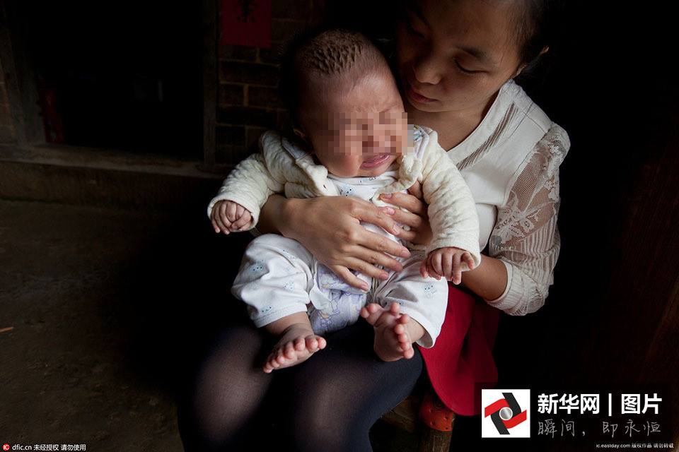 bayi jari banyak © 2016 brilio.net