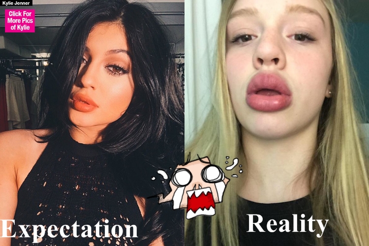 gagal cantik © 2016 brilio.net gagal cantik © 2016 brilio.net