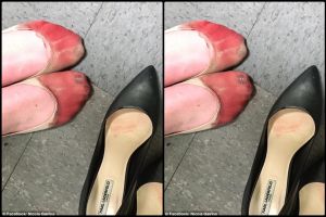 Kerja seharian pakai sepatu hak tinggi, kaki wanita ini mandi darah