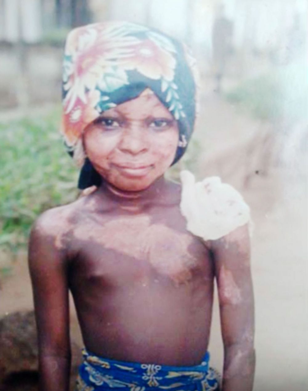 Shalom Nchom © 2016 brilio.net