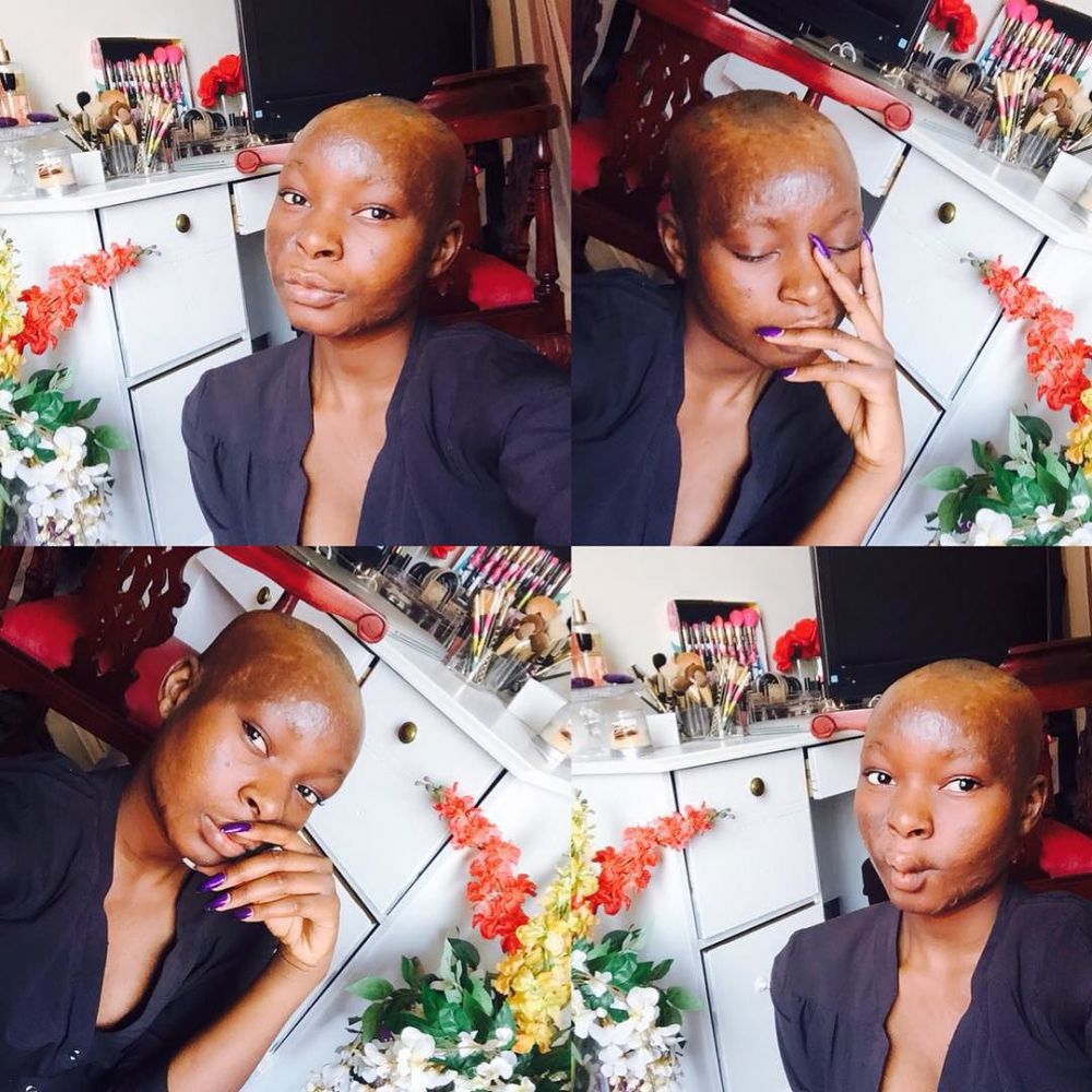 Shalom Nchom © 2016 brilio.net