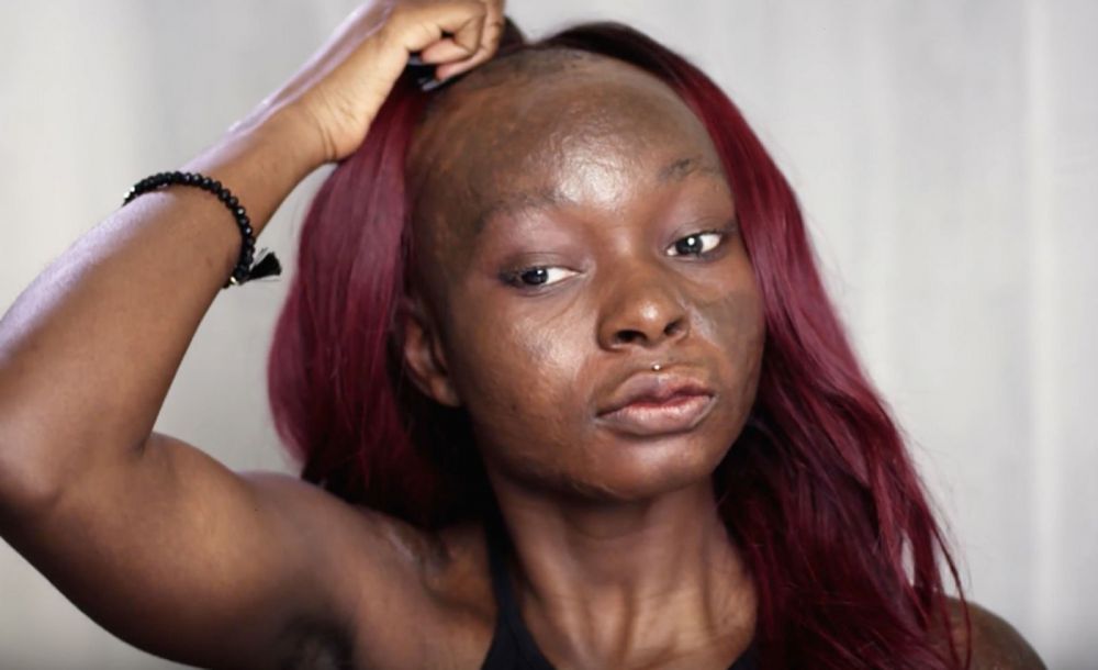 Shalom Nchom © 2016 brilio.net