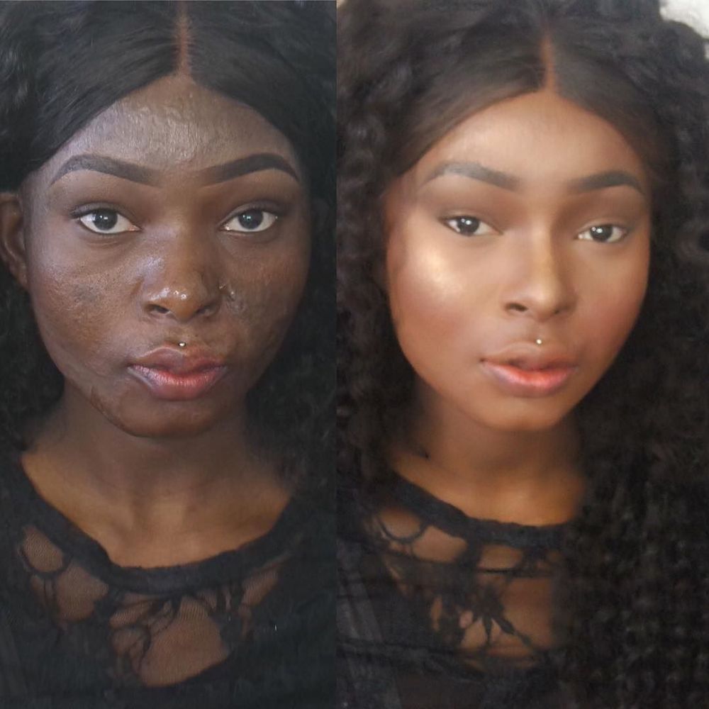 Shalom Nchom © 2016 brilio.net