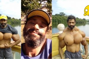 Disuntik agar terlihat kekar, pria ini malah punya 'buah dada'