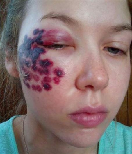 Molly © 2016 brilio.net Molly © 2016 brilio.net