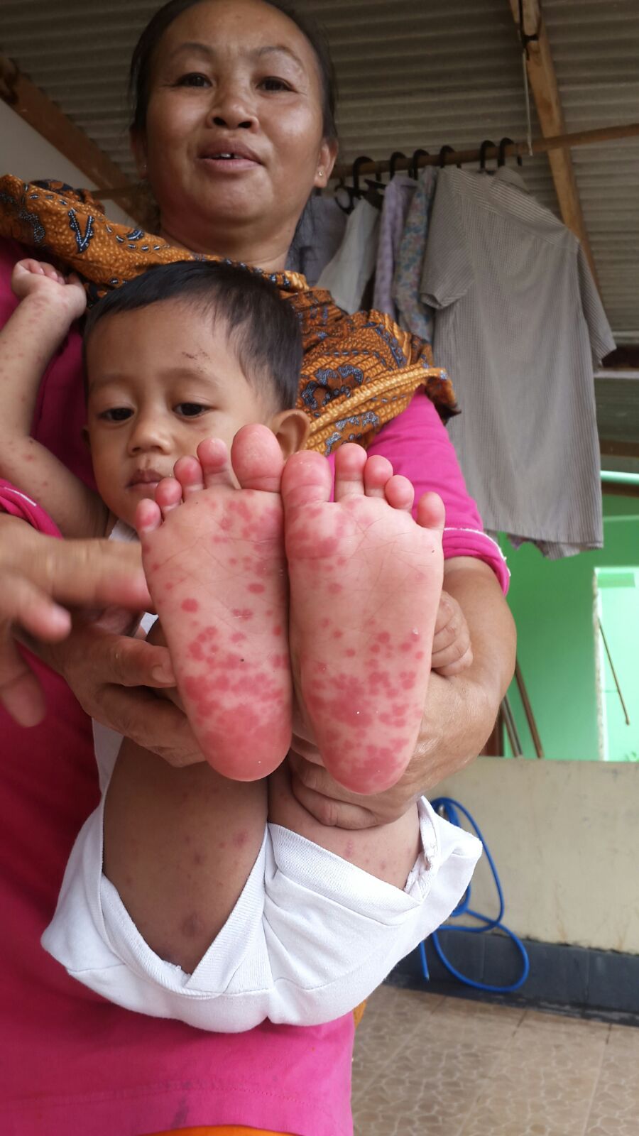 flu singapura © 2016 brilio.net flu singapura © 2016 brilio.net