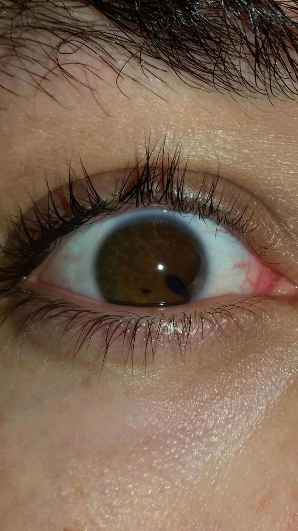 20 Foto bikin ngilu & merinding © 2016 brilio.net 20 Foto bikin ngilu & merinding © 2016 brilio.net