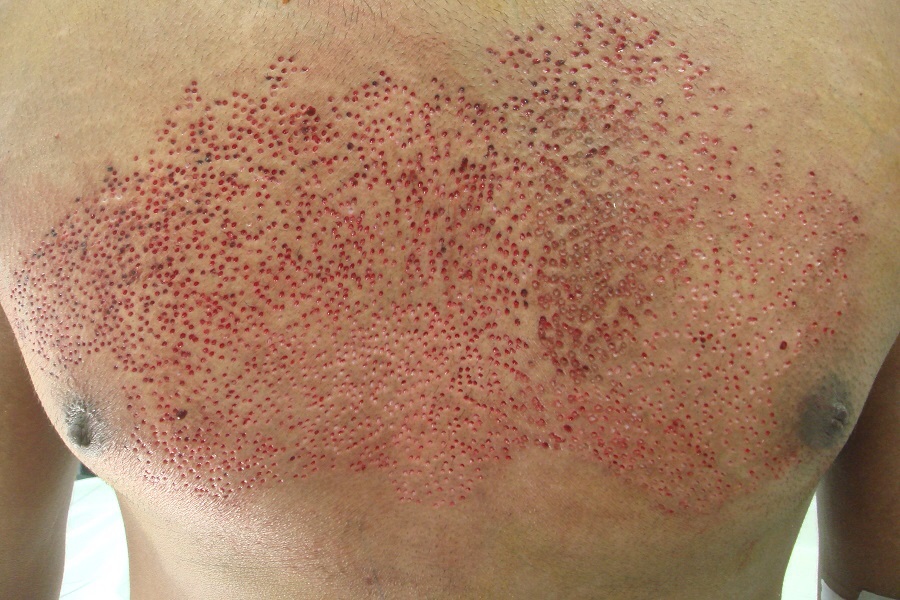 20 Foto bikin ngilu & merinding © 2016 brilio.net 20 Foto bikin ngilu & merinding © 2016 brilio.net