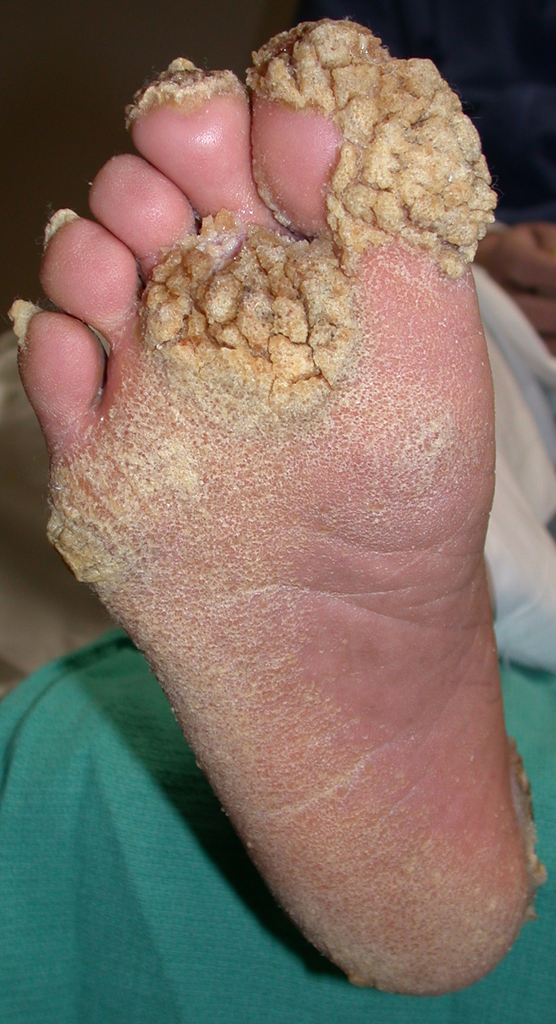 20 Foto bikin ngilu & merinding © 2016 brilio.net 20 Foto bikin ngilu & merinding © 2016 brilio.net