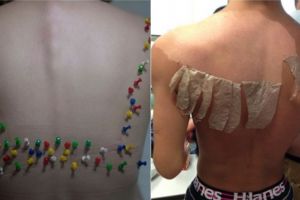 20 Foto 'horor' ini dijamin bikin kamu ngilu dan merinding sendiri! 