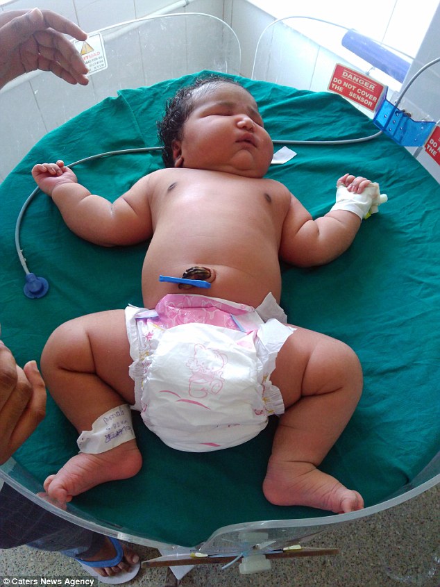 Bayi ini terlahir dengan berat  6,8 kg! Diklaim terberat dunia...