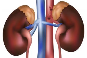 5 Tanda sepele penyakit gagal ginjal yang sering diabaikan, catet!