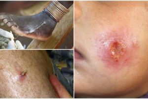 10 Parasit mengerikan ini bisa menyerangmu kapan saja, hati-hati ya!