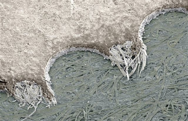 foto mikroskop © 2016 brilio.net foto mikroskop © 2016 brilio.net