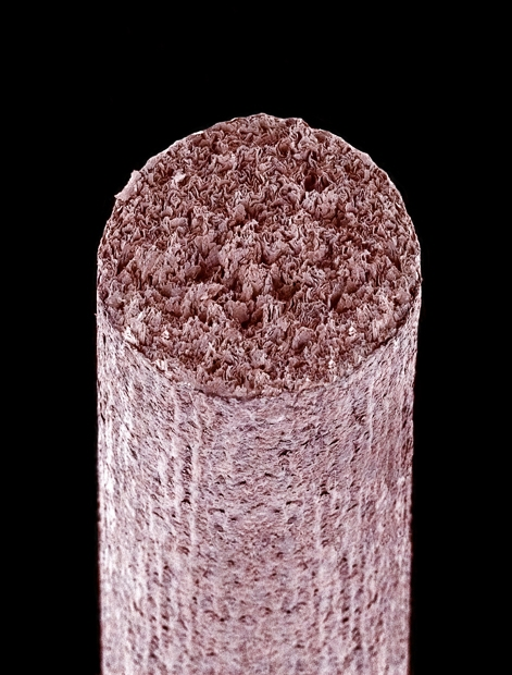 foto mikroskop © 2016 brilio.net foto mikroskop © 2016 brilio.net