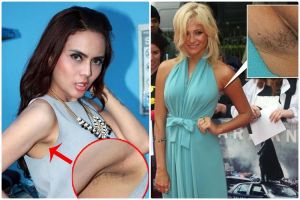 13 Artis cantik ini ternyata 'lupa' mencukur bulu ketiaknya