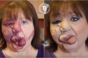 Berkat makeup, wanita ini ubah tanda lahir langka jadi riasan cantik!