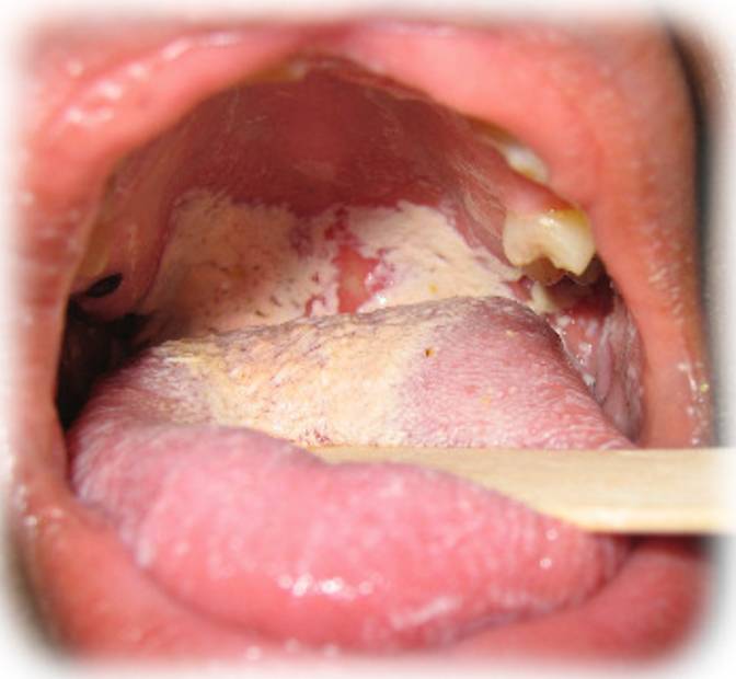 kondisi lidah © 2016 brilio.net kondisi lidah © 2016 brilio.net