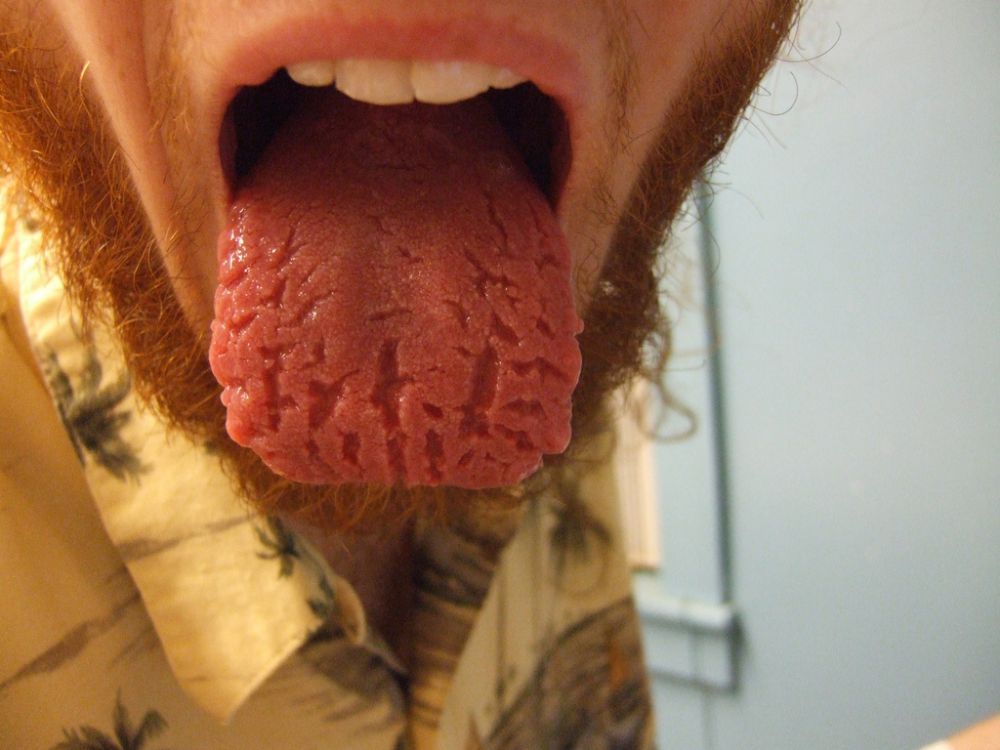 kondisi lidah © 2016 brilio.net kondisi lidah © 2016 brilio.net