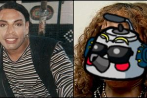 Ingin cantik dengan operasi plastik, wajah wanita ini malah jadi ngeri