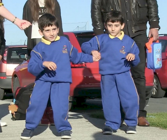 kisah kembar siam © 2016 brilio.net kisah kembar siam © 2016 brilio.net