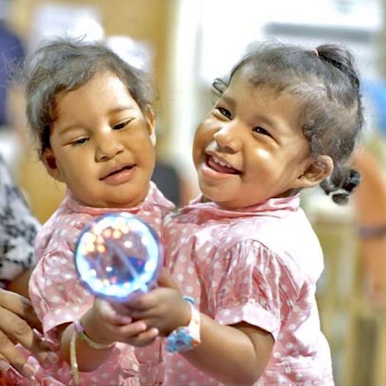 kisah kembar siam © 2016 brilio.net kisah kembar siam © 2016 brilio.net