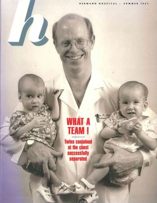 kisah kembar siam © 2016 brilio.net kisah kembar siam © 2016 brilio.net