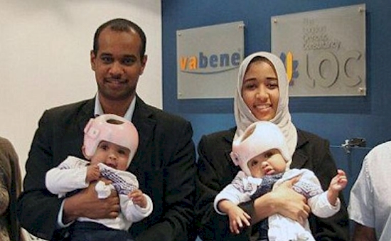 kisah kembar siam © 2016 brilio.net kisah kembar siam © 2016 brilio.net