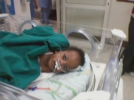 kisah kembar siam © 2016 brilio.net kisah kembar siam © 2016 brilio.net