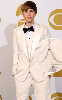 artis lupa resleting © 2016 brilio.net