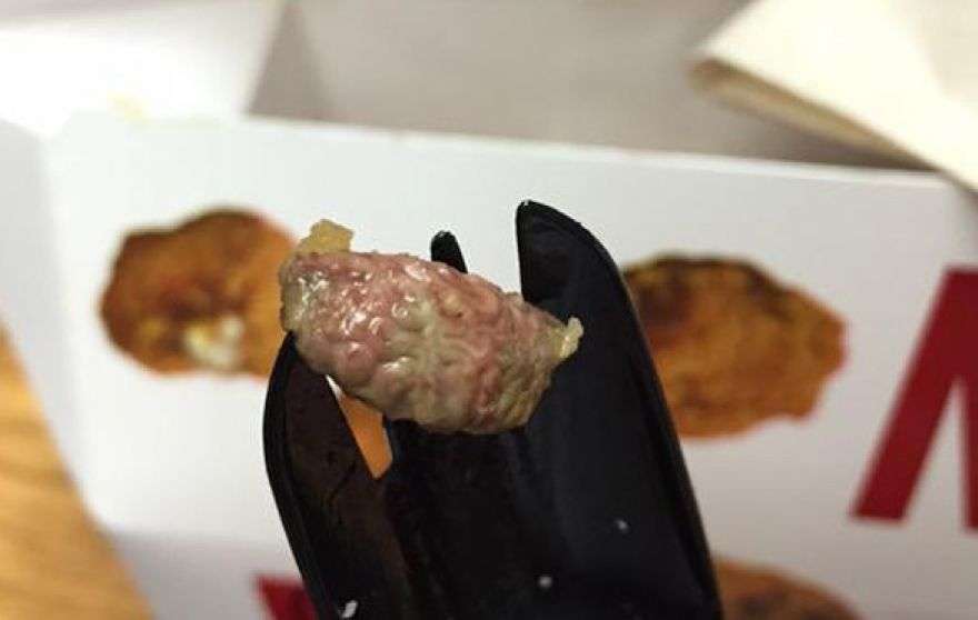 Benda menjijikkan di fast food © 2016 brilio.net Benda menjijikkan di fast food © 2016 brilio.net