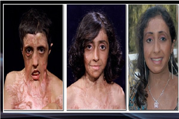 Zubaida Hasan © 2016 brilio.net