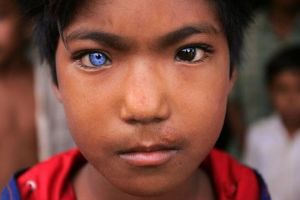 19 Potret orang dengan warna mata yang berbeda sebelah, tahu kenapa?