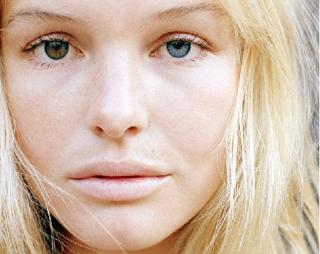 Heterochromia Iridium © 2016 brilio.net Heterochromia Iridium © 2016 brilio.net