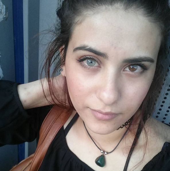 Heterochromia Iridium © 2016 brilio.net Heterochromia Iridium © 2016 brilio.net