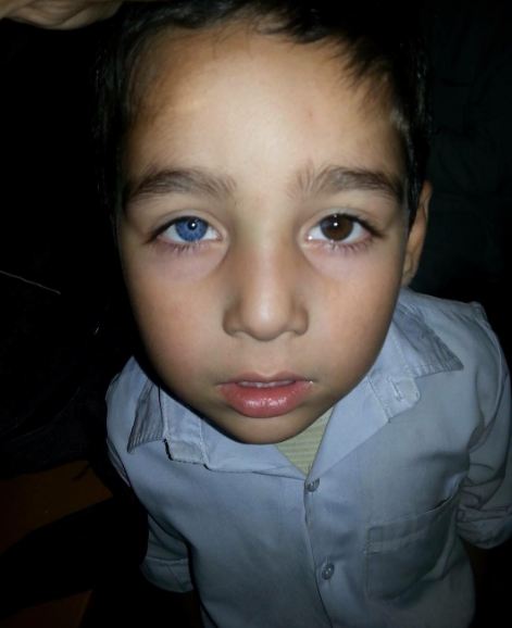 Heterochromia Iridium © 2016 brilio.net Heterochromia Iridium © 2016 brilio.net