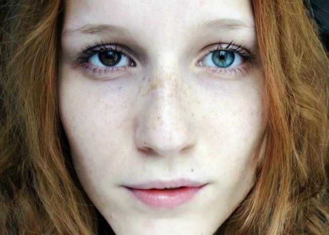 Heterochromia Iridium © 2016 brilio.net Heterochromia Iridium © 2016 brilio.net