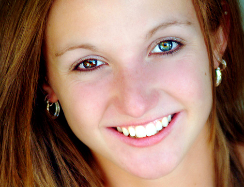 Heterochromia Iridium © 2016 brilio.net Heterochromia Iridium © 2016 brilio.net