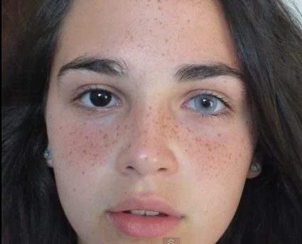 Heterochromia Iridium © 2016 brilio.net Heterochromia Iridium © 2016 brilio.net