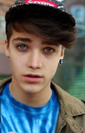 Heterochromia Iridium © 2016 brilio.net Heterochromia Iridium © 2016 brilio.net