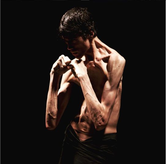 Javier Botet © 2016 brilio.net Javier Botet © 2016 brilio.net