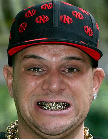 orang dengan gigi emas © 2016 brilio.net orang dengan gigi emas © 2016 brilio.net