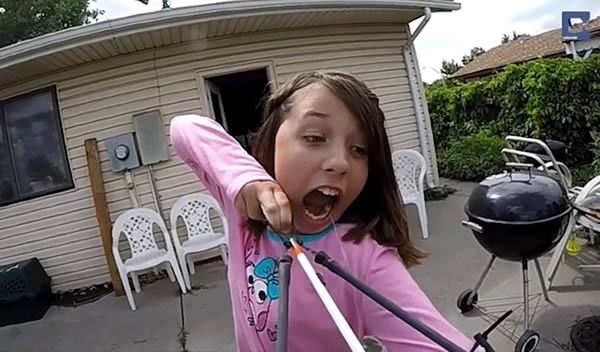 cabut gigi © 2016 brilio.net cabut gigi © 2016 brilio.net