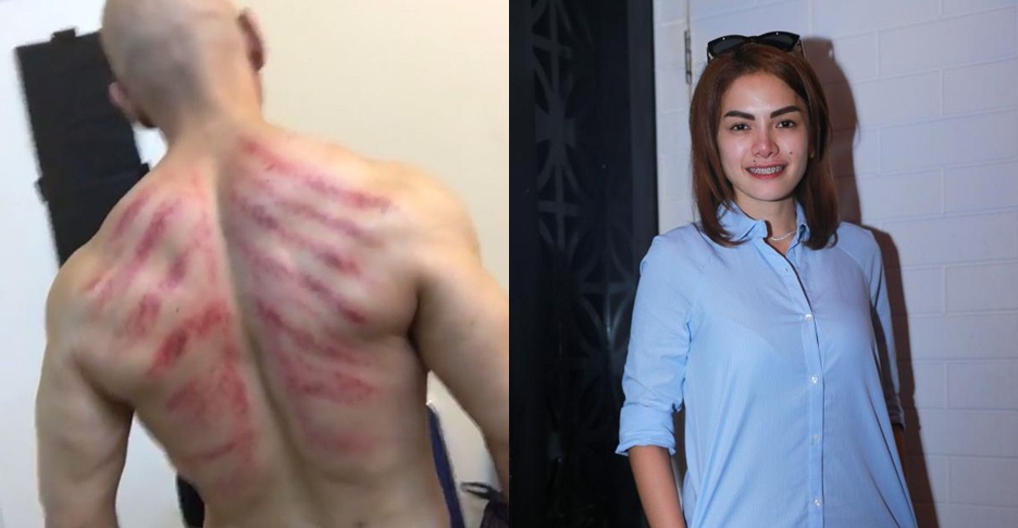 5 Selebriti ini hobi kerokan, wah wah masuk angin nih? 