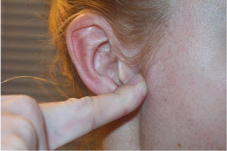 Menekan tonjolan di depan lubang telinga bisa turunkan berat badanmu!