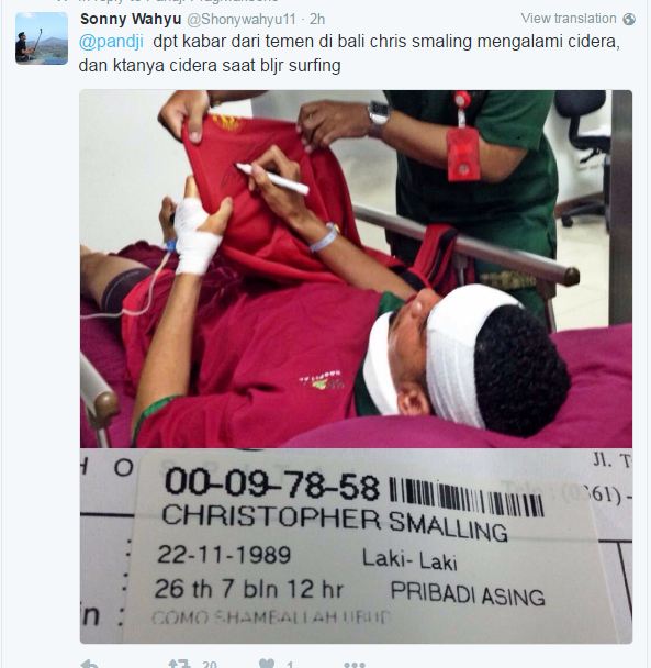 Pemain MU cedera ketika sedang berlibur di Bali