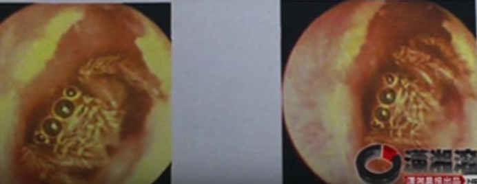 benda seram telinga © 2016 brilio.net benda seram telinga © 2016 brilio.net