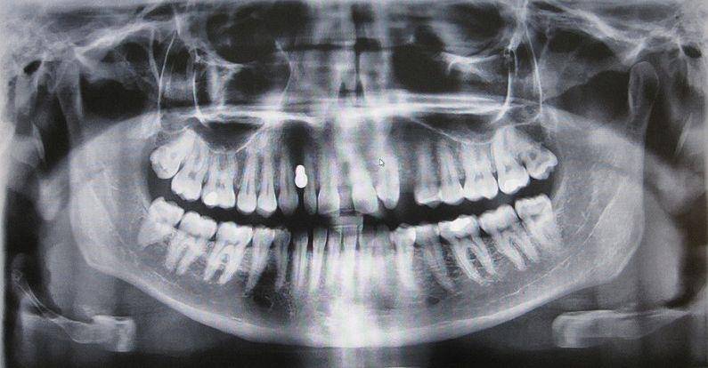 benda seram telinga © 2016 brilio.net benda seram telinga © 2016 brilio.net